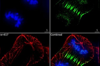 TSU opens English-language Master’s programme in biophotonics